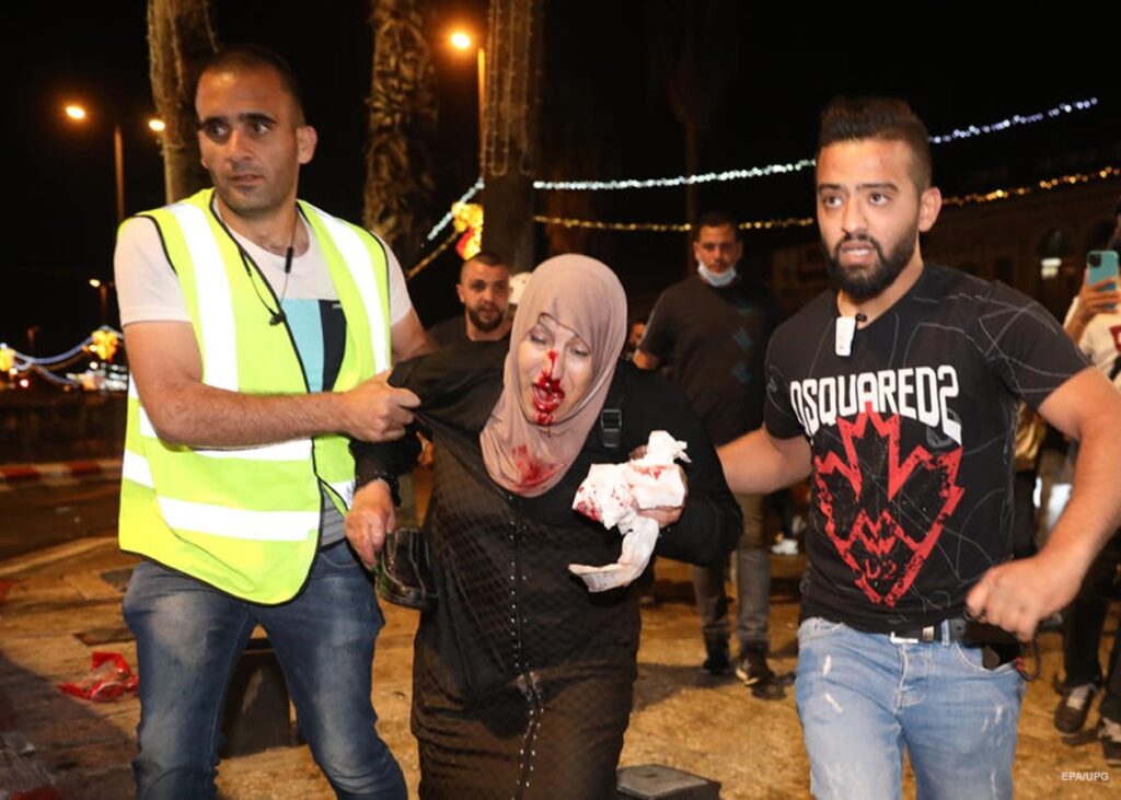 فلسطينية أصيبت باعتداء شرطة الاحتلال في القدس