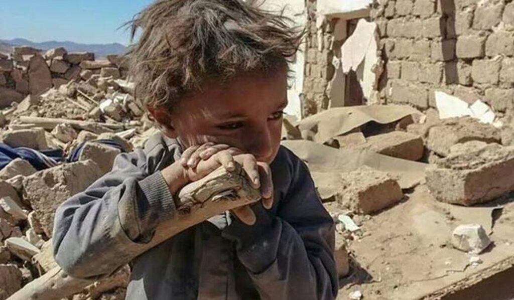 أطفال متضررون من حرب اليمن